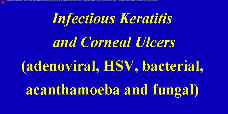 Nieuwe e- learning: INFECTIOUS KERATITIS AND CORNEAL ULCERS